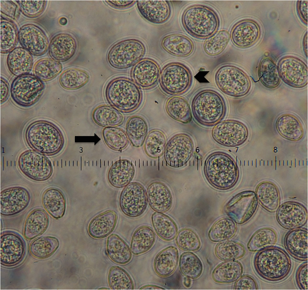 Coccidia observed during fecal flotation. Photo © Miranda R. Bertram, et al. 2015. “Coccidian Parasites and Conservation Implications for the Endangered Whooping Crane (Grus americana).” PLoS One.