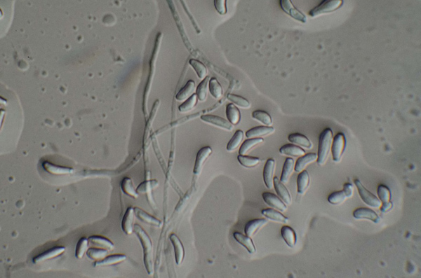 P. destructans, the fungus that causes white-nose syndrome. Photo: © John Neville, Georgia State University