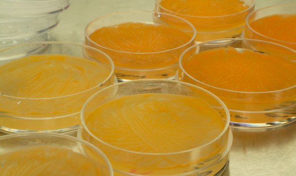 R. rhodochrous cultured in petri dishes at Georgia State University. Photo: © Kyle Gabriel, Georgia State University