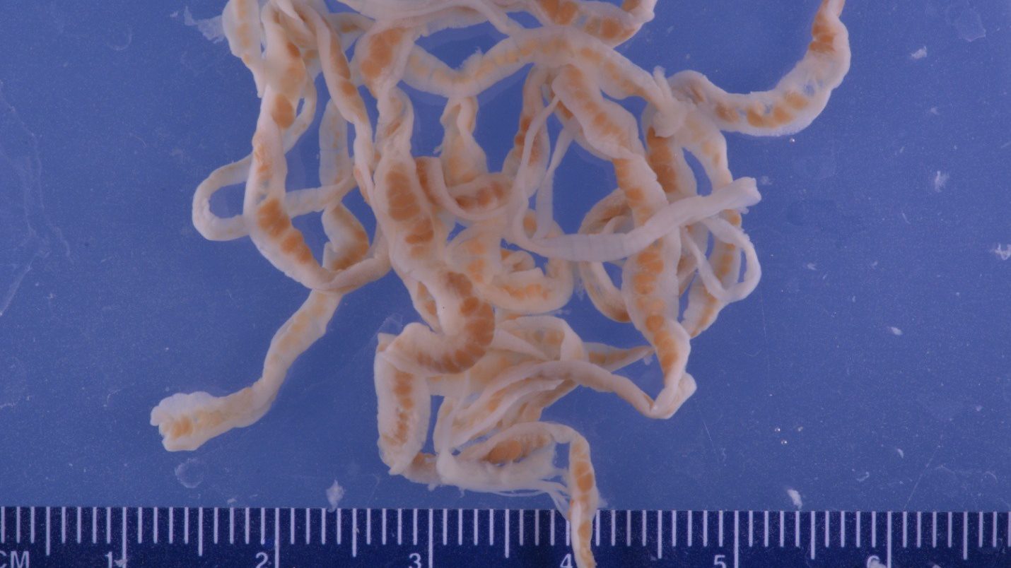 human tapeworm removal
