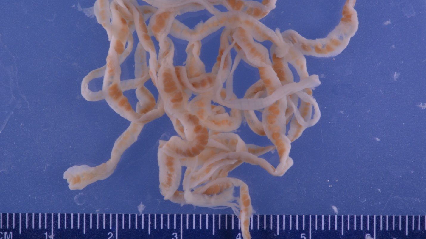 Human Tapeworm Removal